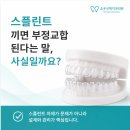 THE(더) 조은 치과의원 | [방이동 조은선택치과] 스플린트 끼면 부정교합 된다는 말, 사실일까요?