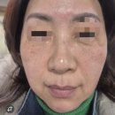 제이비에스테틱 네이버블로그