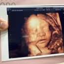 노인화산부인과의원 | [임신] 내가 다닌 산부인과 ‘청담마리’, 병원 진료 후기 공유