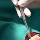 다올치과기공소 | [수원다올치과]크라운 실제 치료 후기와 비용 알려드립니다.