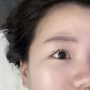 세가지 뷰티 | 용인 처인구피부관리샵 세가지뷰티 MTS 관리 후기
