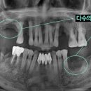 이승훈치과의원 이미지