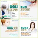 정송우바른이치과의원 네이버블로그