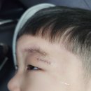 이민녕성형외과 이미지