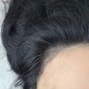 조헤어라인 | 청라두피문신 잘하는 더이녹스칼프, 헤어라인 시술 후 일주일까지의 후기!