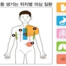 협심증 전조증상 지나치면 위험한 적신호 이미지