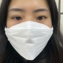 제이미성형외과의원 | 쌍수후기 퀵매몰 한쪽 쌍수 /압구정 제이미성형외과