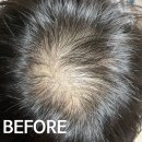 홈 헤어컷(주간) | 홈케어 두피관리 추천 두피진정 탈모관리 홈키트 자란다헤어 솔직후기