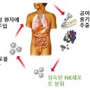 NK기술