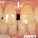 메디포레치과의원 이미지