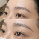 뿅단미피부전문센터 | 강남눈썹문신 잘하는곳 직장인 30대 방문 후기