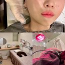 마주본한의원 | 청담역한의원 안면비대칭교정 전후 비용 솔직후기