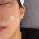 풍암동 피부관리 고운수아피부케어센터 광주 히알패치