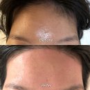 에이스헤어 (샵) | 일산 정발산 라페스타 왁싱 잘하는 곳 <에이스왁싱> 헤어라인 후기