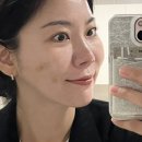 (주)강남일급정비공장 | 청담피부과 콜라겐부스터 엘라비오리투오 시술후기