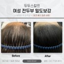 두두스칼프