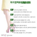 하지정맥치료 초기에 잡아야 합니다. 이미지