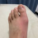 민컴퓨터 | 셀로비스 요사민 효과 후기