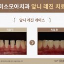 미소나래치과의원 이미지