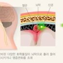 낮잠 효과 두통 이유 및 관리법 알아봐요 이미지