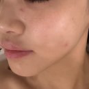 라메드 스킨케어 이미지