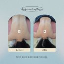 더블유진병원 | [부천 신중동] 등관리 장인 라비에벨뷰티 20년 경력 수기관리로 갱년기 붓기 타파한 후기