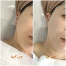 현대소망세탁전문점 | 동래피부관리 사직동피부샵 스웰드 클리어밸런스진정케어 후기