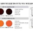 아이티메디컬 이미지