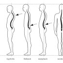 에르모 필라테스 이미지