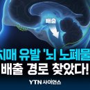 치매 유발 '뇌 노폐물' 배출 경로 찾았다!…치료제 개발 가능성 | 과학뉴스 24.01.11 이미지
