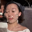 영양쎈타 분당점 | [분당 안면홍조] 스테른클리닉, 속건조 피부 1:1 맞춤 케어받고 광명 찾은 후기