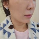 김피부과의원 | 대구 동성로 피부과 의원 추천, 민트실리프팅 내돈내산 찐후기