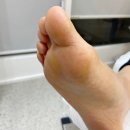 레푸스 연산점 이미지