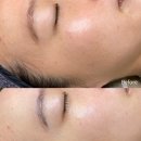 고목나무 | (대구 읍내동) 1:1 맞춤 대구 칠곡 피부관리 맛집 추천 인간 고목나무 탈출 후기 - 다온뷰티