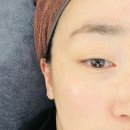 이음메디칼 | 쌍문에스테틱 이음메디컬스킨 기미관리후기 + 짱짱 친절하신 부원장님