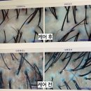 탑스칼프 청주점