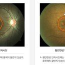 하나안과의원 이미지