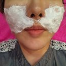 자미한의원 | 노원한방성형 노원팔자주름 노원리프팅 후기