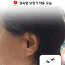 시그니아 독일보청기 이미지