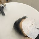 아테네헤어클리닉
