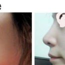 아름다운성형외과 이미지