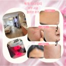 까진눈썹 | 목포 눈썹 맛집 하나뷰티 피부 시술도 좋아?? 블러샷 시술 후기