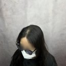 일러스라인 | 탈모로 비어있던 정수리, 일러스라인smp에서 완벽해결 본 후기