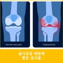 골다공증 예방에 도움 되는 3가지 영양소 이미지