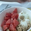 유로팜(주) | 일산 동국대 병원 자궁근종 제거 수술 후기_퇴원 후 일상, 최종비용, 실비청구