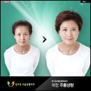 압구정서울성형외과 네이버블로그