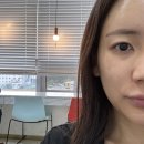 연세김동철성형외과의원 | 청주 연세강연웅성형외과 예약 성공 후기｜254통 끝에 쌍수 예약 성공!