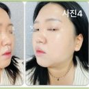 뷰온뷰티피부관리