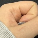 행복한마트 | 2월 행복한 하루들(+수술 후기)