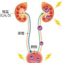 방광염이나 신우신염이 되기 쉬운 것은 남자？ 여자？ 이미지